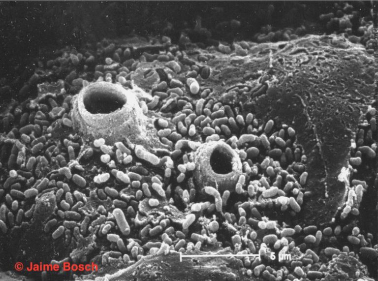 Epidermis de un sapo muerto por quitridiomicosis en el que se observan los tubos de descarga de los esporangios de B. dendrobatidis . Microscopio electrónico de barrido © Jaime Bosch